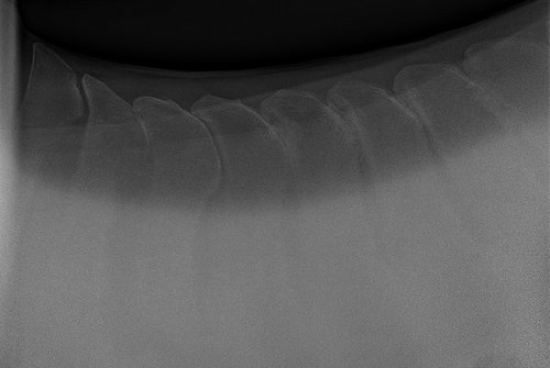 Back Radiographs.jpg