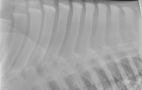 Thoracic