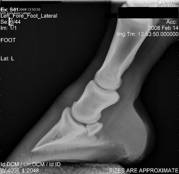 Lateral View of a Foot